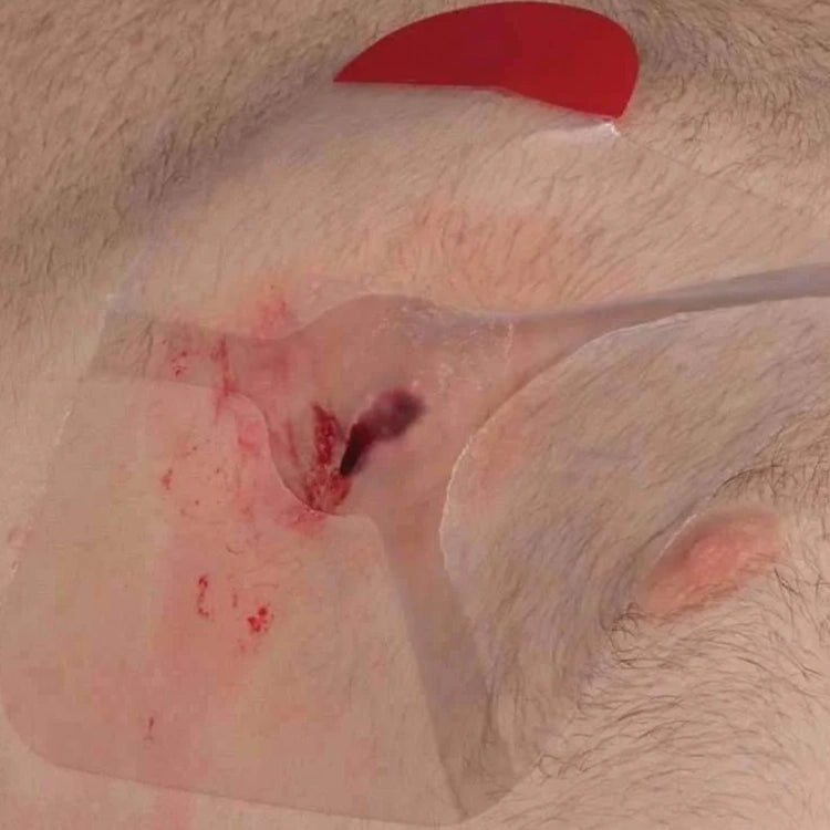 4-CHANNEL DESIGN CHEST SEAL VENTED - FairD Canada